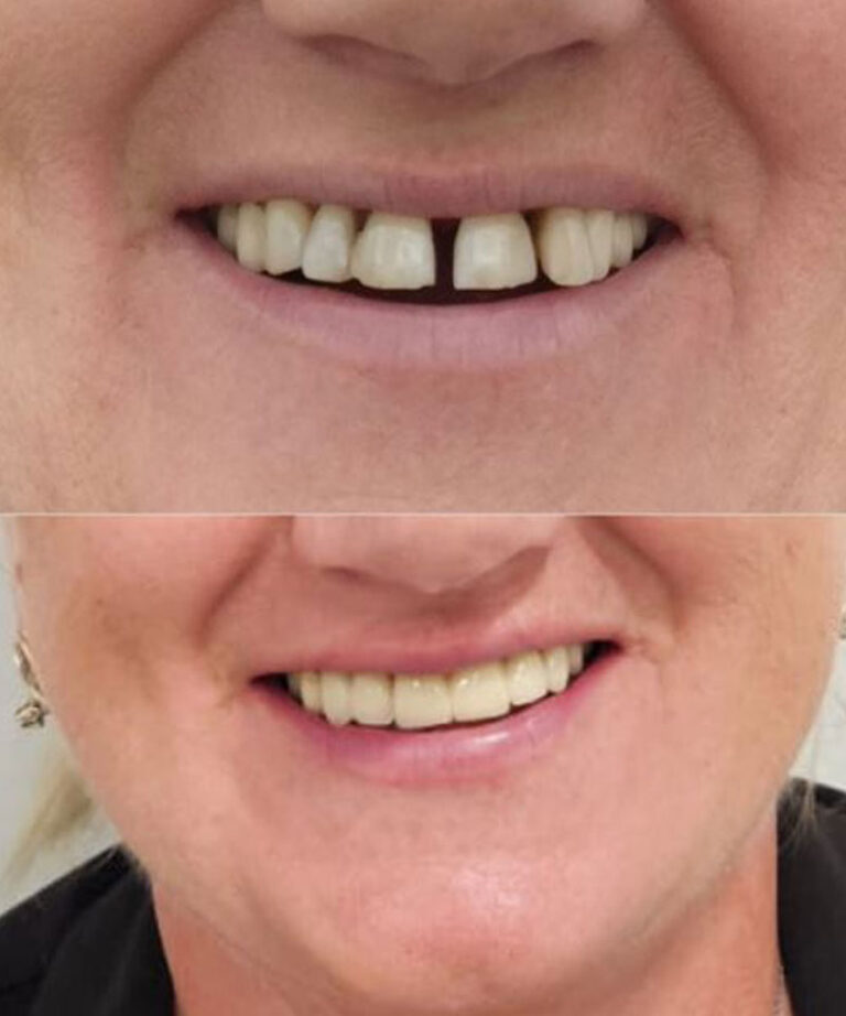 Ortodoncia Gran Canaria: Endodoncias, Implantes y Periodoncia en Detalle